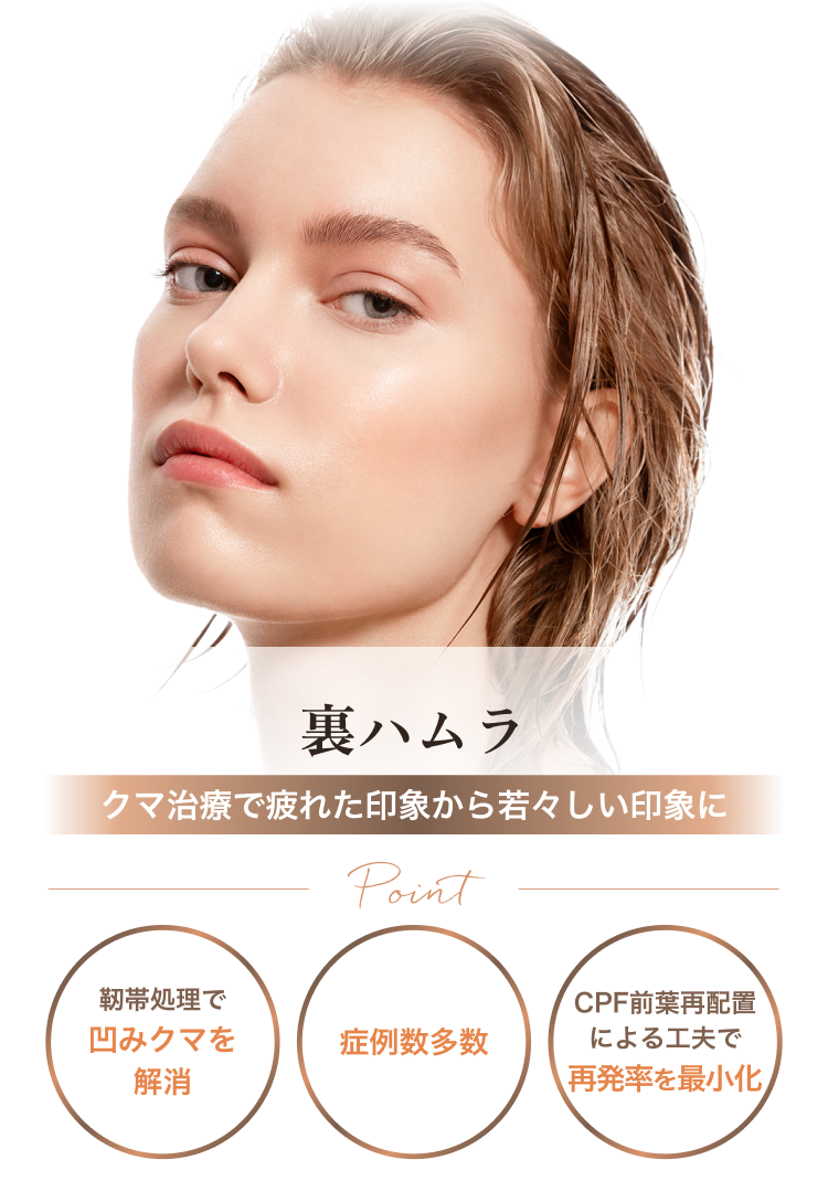 裏ハムラ