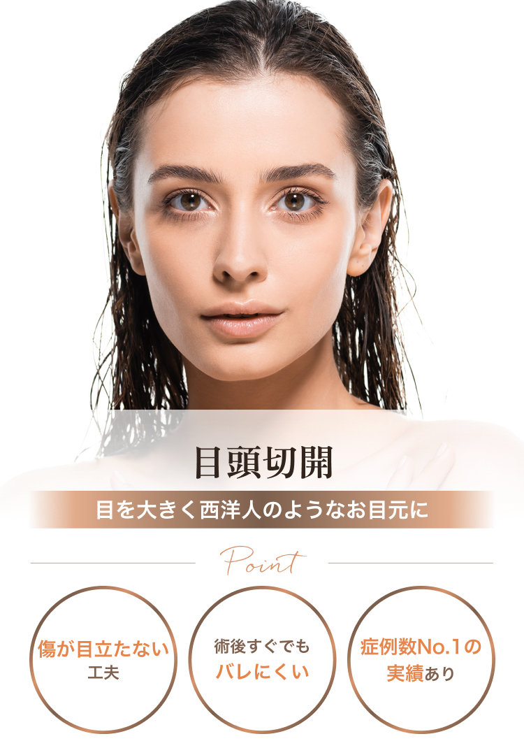 目頭切開